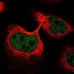 ANKDD1A Antibody, Novus Biologicals:Antibodies:Primary Antibodies